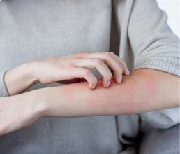 Allergy Control Treatmnet